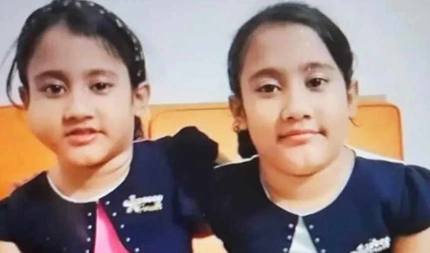 কুমিল্লার যমজ বোন সারিনা-সাইবা বার্ন ইনস্টিটিউটের সিসিইউতে